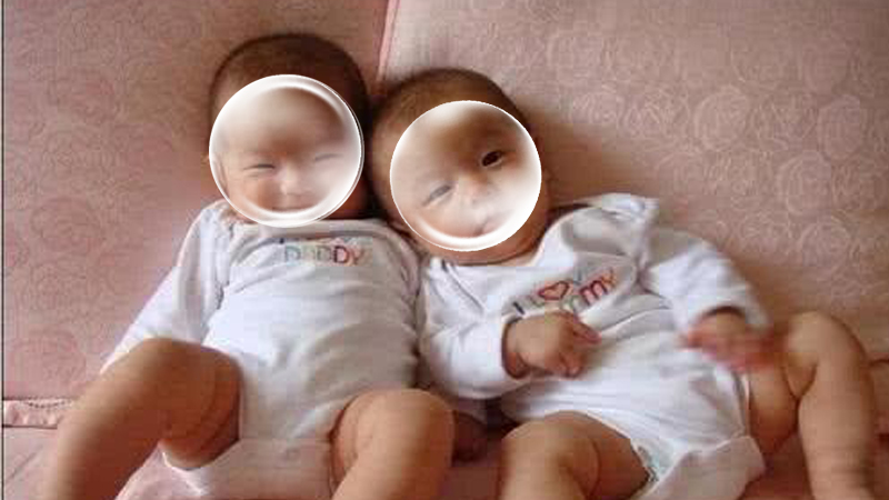 Uterus-free mother achieves twins through IVF in the United States