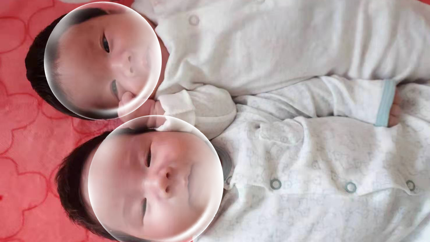 Uterus International Medical helps bring twin brothers into the world